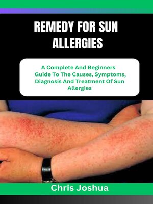 cover image of REMEDY FOR SUN ALLERGIES